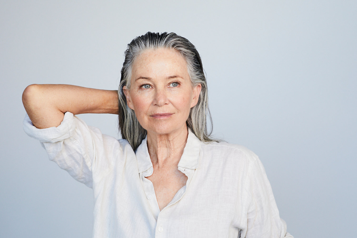 Laser Pigmentation Treatment Sydney – Fotona StarWalker & SP Dynamis